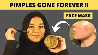 PIMPLE SOLUTION - NEEM FACE MASK | 100% Results !! Magic Drink for Glowing Skin | Ramsha Sultan