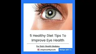 5 Healthy Diet Tips To Improve Eye Health #shorts