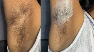 Full growth armpits Waxing by Rica liposoluable wax/Underarms Waxing vlog/ #skincare #beauty #waxing