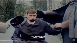 1918: WW1 Veterans Real Footages (Shell shock, war neurosis) - FULL HD COLORIZED