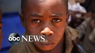 Madagascar donations pour in from &lsquo;World News Tonight&rsquo; viewers l WNT