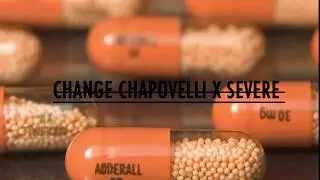 Severe bc X Change Chapovelli = Adderall