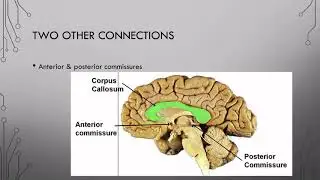 10 Hemispheric Specialization Pt 2