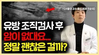 유방암 조직검사 후 ‘암 아닙니다’ 들었어도.. 계속 검사해야 할 2가지 경우
