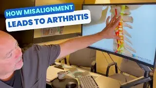 How Long Term Spinal Misalignment Leads to Arthritis