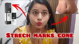Best stretch marks cream |throveco stretch marks cream review thrive co stretchmarks cream with demo