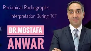 Periapical Radiographs Interpretation During RCT || Dr. Mostafa Anwar