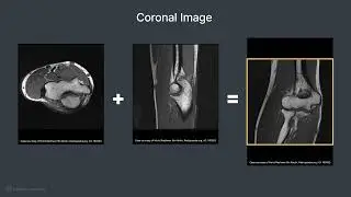 Patient Positioning and Protocol for an Elbow MRI