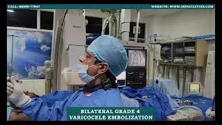 Bilateral Grade 4 Varicocele Embolization by Dr. Sandeep Sharma | IRFACILITIES