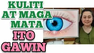 Kuliti at Maga sa Mata - Payo ni Doc Liza Ong #327