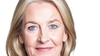 Understanding Eyelid Surgery Options | With Dr. Ellen Ezell, MD at Clark Institute for Aesthetics