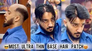 Best Ultra Thin Hair Patch | Permanent Hair Patch Delhi | Call on 9650914665