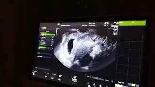 Ramzi theory It's a GIRL 😍