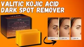 VALITIC Kojic Acid Dark Spot Remover Soap Bars | The Best Solution for Dark Spots!