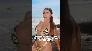 FOREHEAD REDUCTION 💆🏻&zwj;♀️ + RHINOPLASTY 👃🏼 + BREAST AUGMENTATION 👙 Dr. Ahmet Dilber ✨