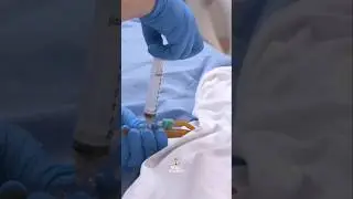 Urine Specimen Collection From an Indwelling urinary catheter (Foley) #nursing #practice #medical