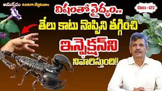 🦂 Scorpion Sting First Aid | Free Classes 423 | B. Anjaneya Raju #sreesannidhitv