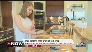 WATCH: Local teen inspired by skin condition creates special bath product business