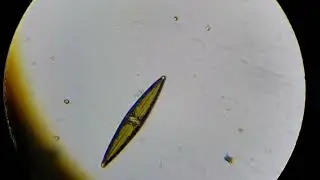 Microfauna In The Swamp Jar