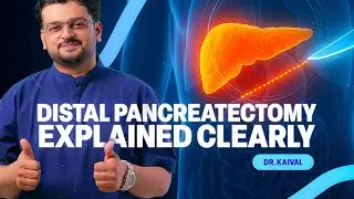 Distal Pancreatectomy Explained | Pancreatic Tail & Body Tumor Surgery
