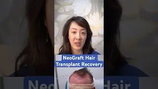 NeoGraft Hair Transplant Recovery: What to Expect at 2 Weeks Post-Op - Face the Facts with Dr. Wang