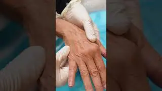 Filler for Hands