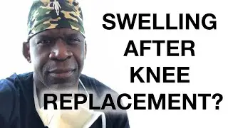 Swelling after TOTAL KNEE REPLACEMENT (arthroplasty)? Dr. Chris Explainers #shorts
