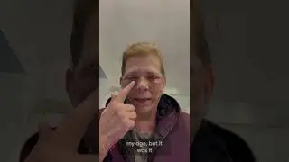 Day 5 Post Surgery Swelling, Healing Reflections, and a New Beginning