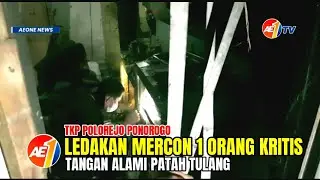 MERCON MELEDAK, 1 ORANG KRITIS TANGAN ALAMI PATAH TULANG