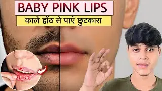 काले होंठ हमेशा के लिए गुलाबी बनाओ🔥| 1 Week Challenge &ndash; Black Lips to Baby Pink Lips Naturally