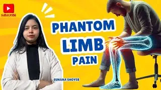Phantom limb pain | phantom sensation |Etiology| Peripheral Theory| Central Theory| Spinal Theory .