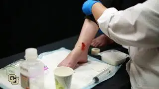 How to treat a snake bite wound