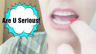 Lower Dentures and my Story - How to Cope With Wearing Dentures at a Young Age