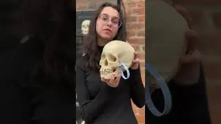 Leprosy affects on the skull