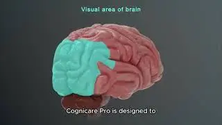 Cognicare Pro Honest Review: Benefits, Side Effects