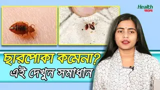 ছারপোকা থেকে বাঁচতে করণীয় । Ways Of Bug Clean । Bug In BED