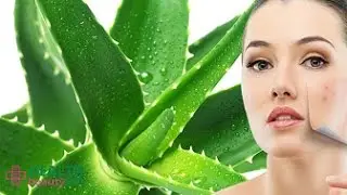 8 Secrets to Get Rid of Chicken Pox Scars Quickly!