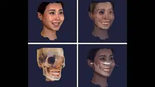 Dental Avatar