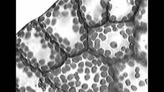 Low temperature-induced chloroplast relocation mediated by a blue light receptor, phototropin&nbsp;2, in