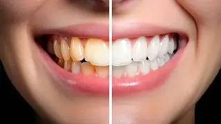 Aprenda a Clarear Dentes no Photoshop de Forma Simples e Rápida