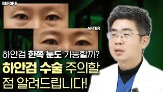 하안검 한쪽 눈도 가능할까?👀 하안검 수술 주의할 점 알려드립니다!