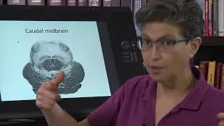 6.8 Cross Sections of the Midbrain