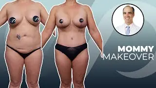 Mommy Makeover Post-op | Dr. David Stoker | Los Angeles, CA