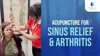 Acupuncture for Sinus Relief & Arthritis | Affordable chiropractors Charlotte NC