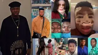BIG WAHALA FOR NIGERIAN COMEDIAN ZICS ALOMA AFTER NOSE SURGERY,OGB RECENT,NASBOI REACTED