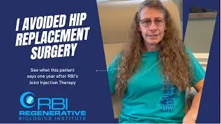 Avoiding JOINT REPLACEMENT is Possible! | Joint Replacement Alternative | RBI Vero Beach