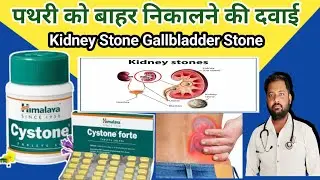 Cystone tablet | Cystone tablet uses in hindi | Cystone tablet side effects