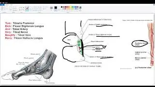 Tarsal Tunnel