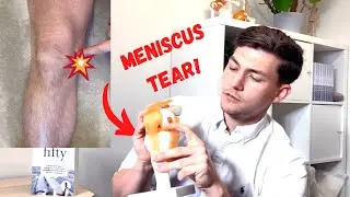 The TWO Types of Meniscus Tear: Symptoms, Causes & Treatment