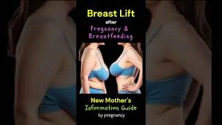 Breast Lift After Pregnancy & Breastfeeding #breastlift #newmomstruggles  #afterpregnancy
